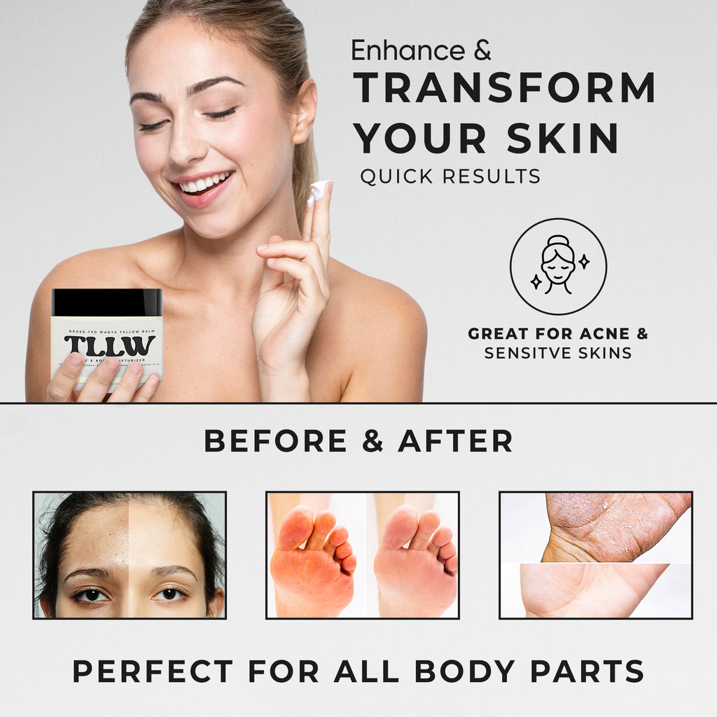 TLLW Moisturizer